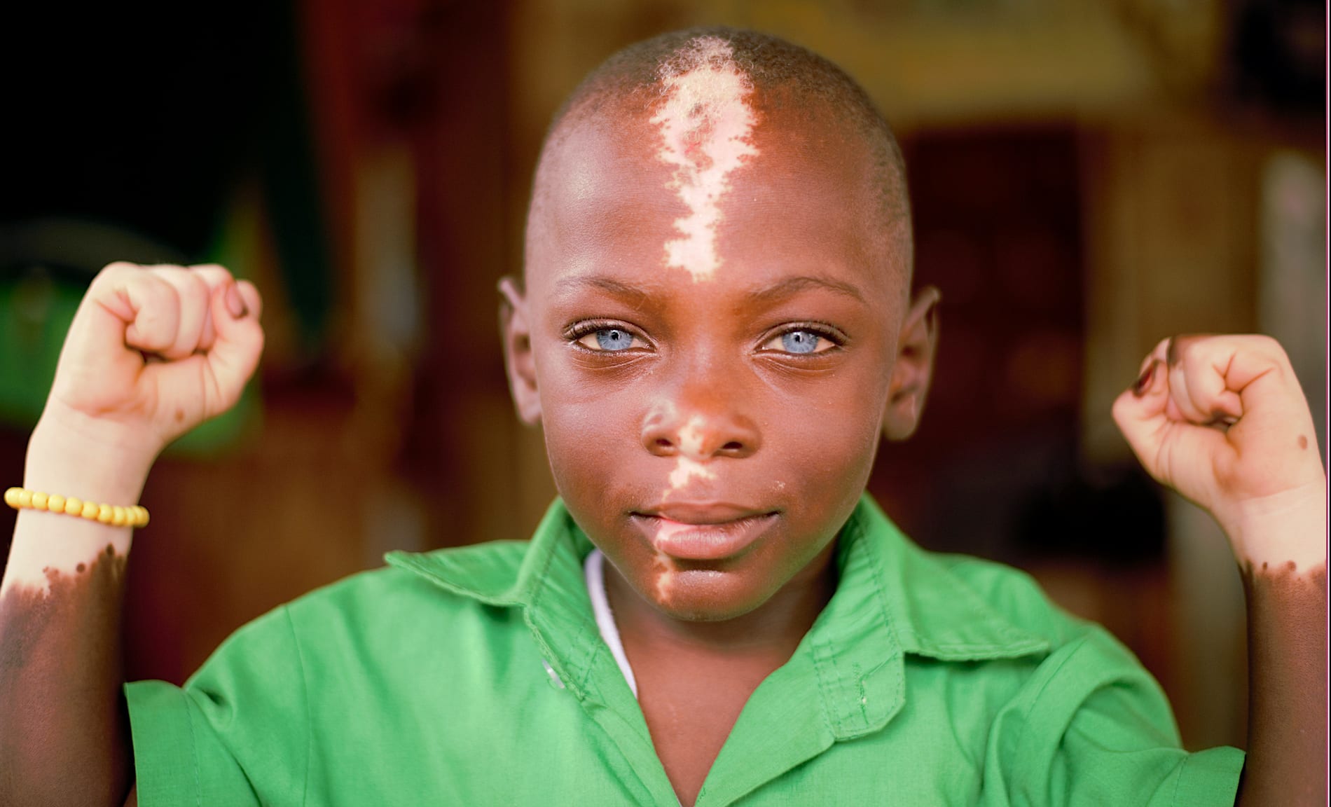 An inspiring update on the boy with the bright blue eyes - Compassion Canada