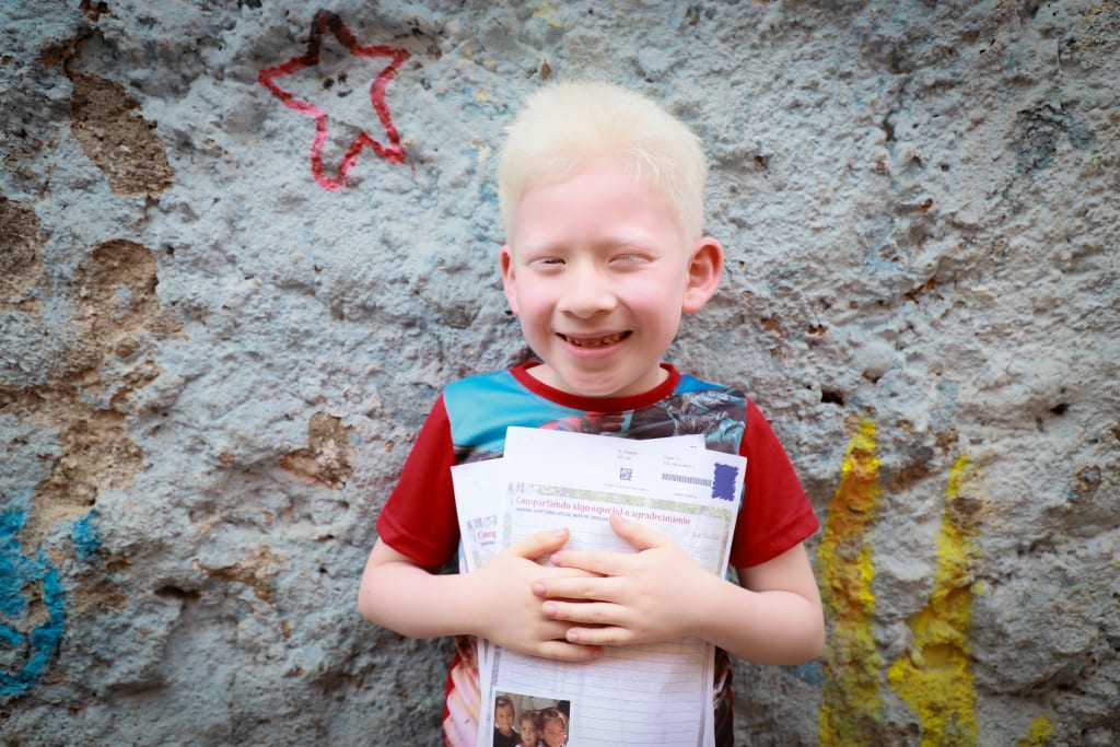 A young albino boy stands in front of a wall and embraces some letters.
