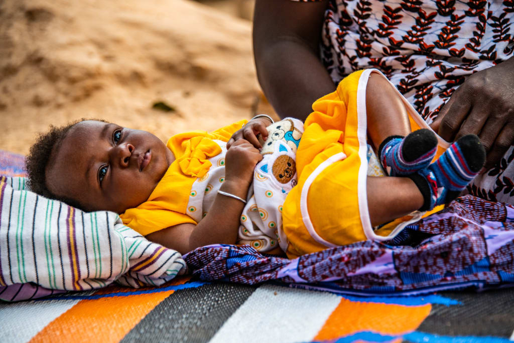 A baby girl in a yellow dress lays on a striped blanket.