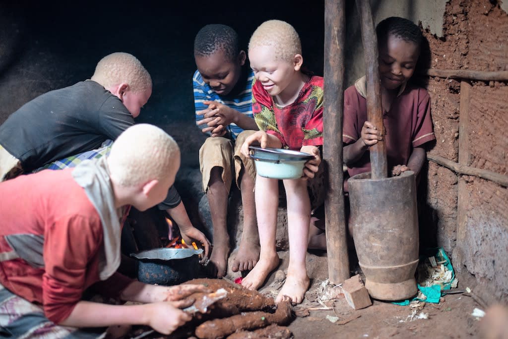 Five siblings, three of whom have albinism, sit together outside their home.