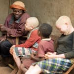 Links to 5 things children with albinism want you to know