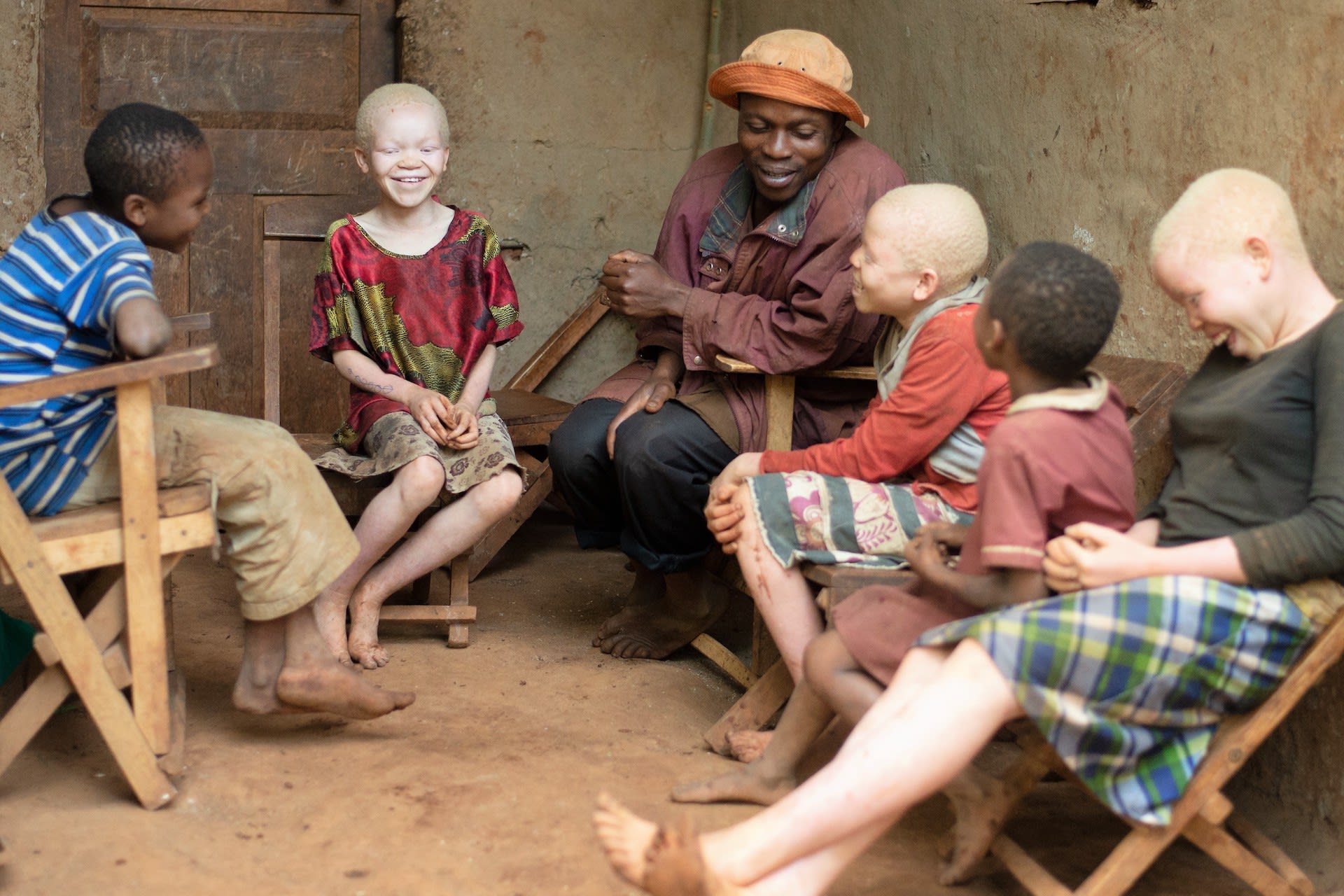 A father sits with his five children. Three of them have albinism.